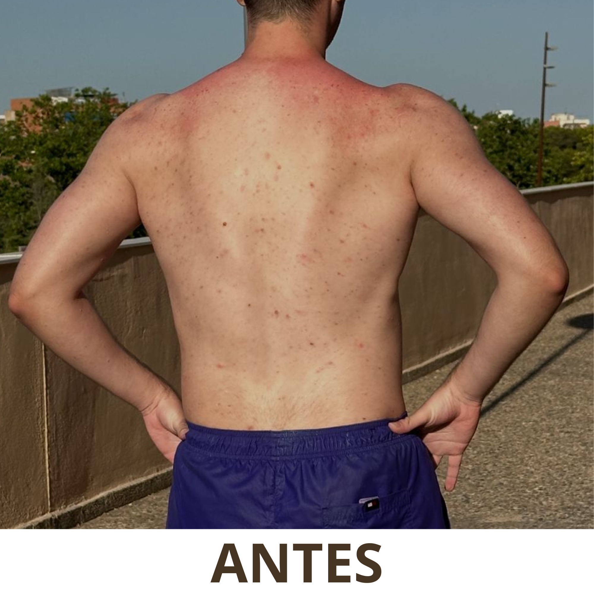 Jabón Artesanal de Azufre